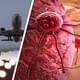 Опасно ли летать на самолётах: бортпроводник заболел раком из-за радиации в полёте и умер