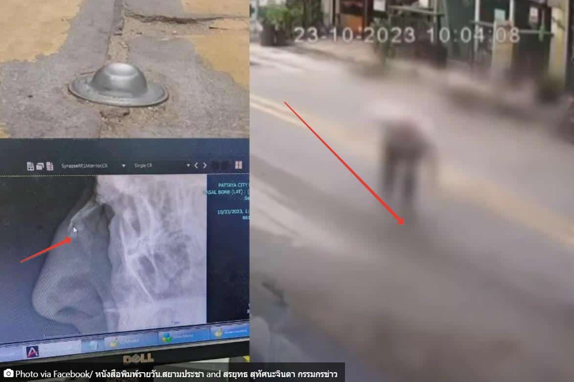 Туристы продолжают спотыкаться в Паттайе и получать увечья на одном и том же месте