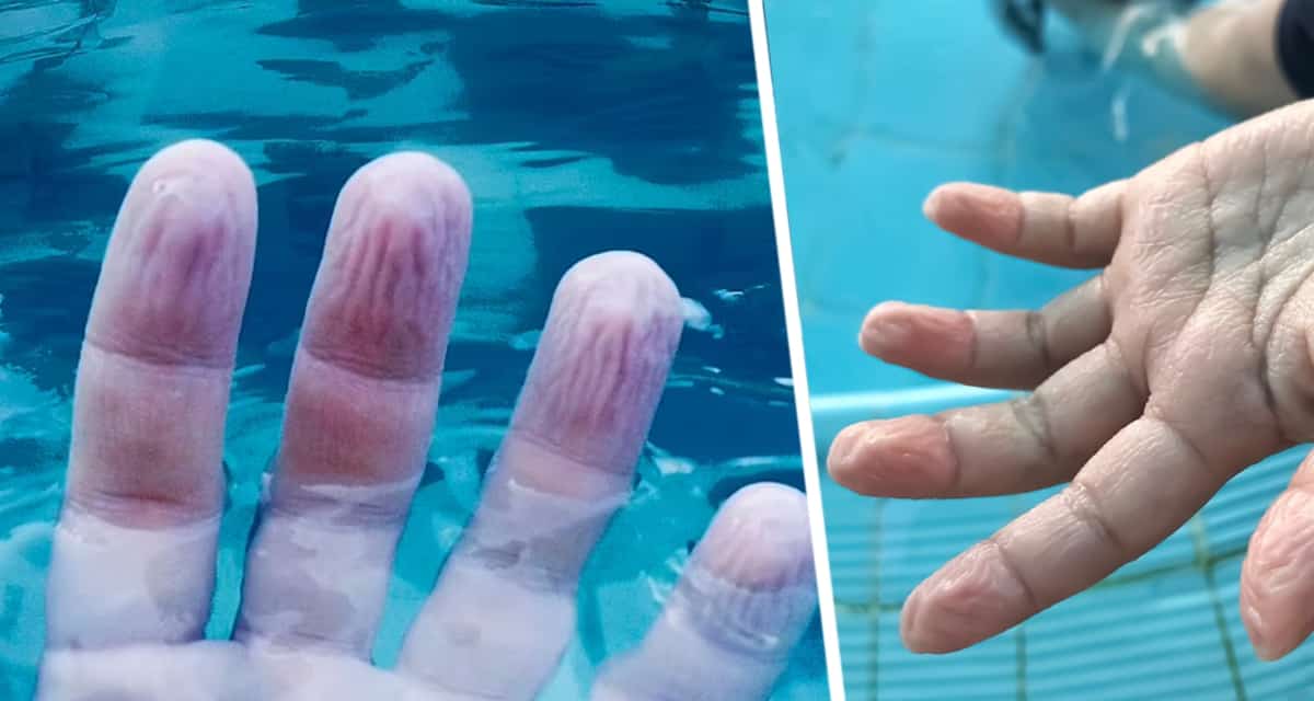 Ученые выяснили, почему ваши пальцы сморщиваются, когда вы лежите в ванне или плаваете в бассейне