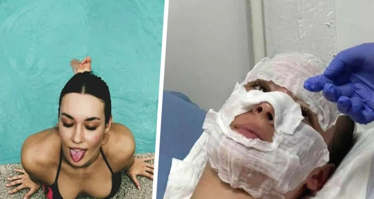 Как туристка недооценила силу солнца в Таиланде и теперь горько об этом жалеет