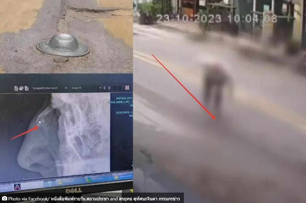 Туристы продолжают спотыкаться в Паттайе и получать увечья на одном и том же месте