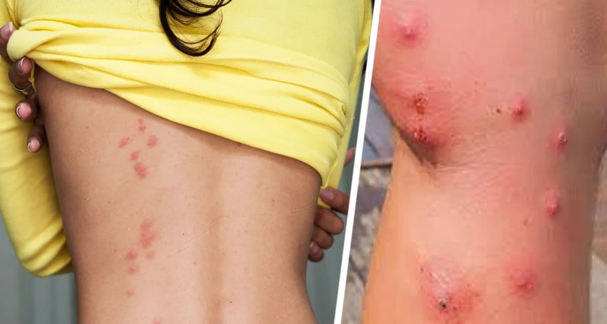 Лаосский отдых обернулся трагедией: смертельное нападение ядовитых насекомых на туристов