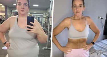 «Я сбросила половину своего веса на Оземпике»: вот что случилось со мной, когда я перестала его принимать «Я сбросила половину своего веса на Оземпике»: вот что случилось со мной, когда я перестала его принимать