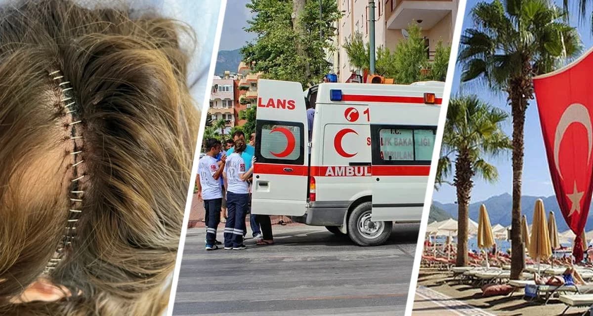 Роковой отпуск в Турции: как «тепловой удар» скрыл смертельную угрозу. История туристки, победившей смерть в Анталии Роковой отпуск в Турции: как «тепловой удар» скрыл смертельную угрозу. История туристки, победившей смерть в Анталии