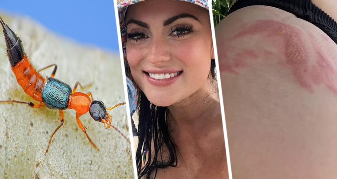 Туристка попала под капельницу после того, как по ней прополз опасный жук на популярном курорте
