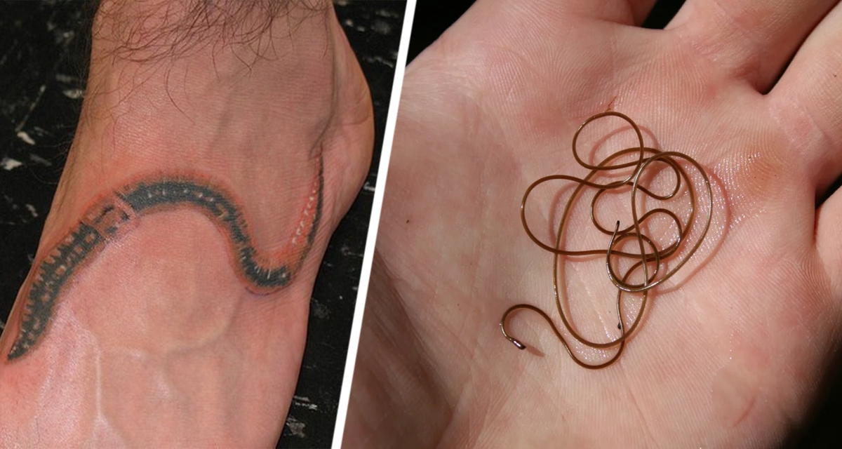 Они ползали в мозге и под кожей: туристов предупредили о страшных червях, которыми можно заразиться в ЮВА