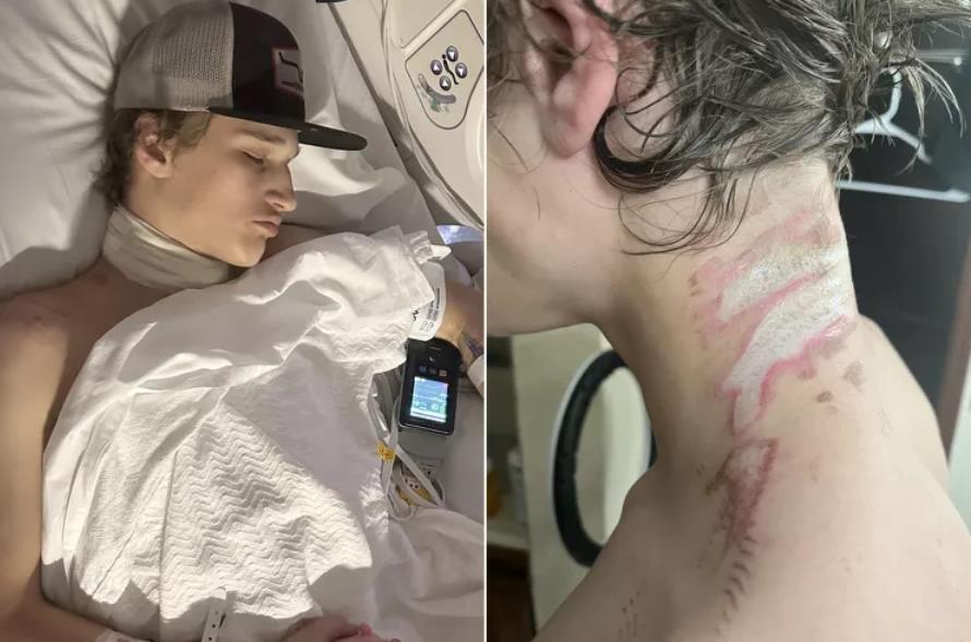 Как на электрическом стуле: 16-летнего парня ударило током из-за его ожерелья в результате нелепого несчастного случая
