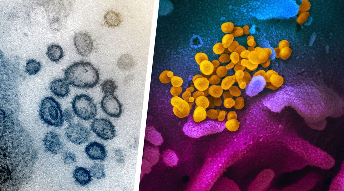 Учеными получены самые четкие изображения нового коронавируса. 8 ФОТО